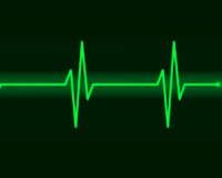 Peut-on faire un électrocardiogramme à un chien ?